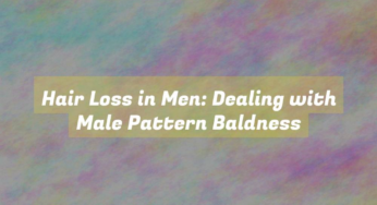 Hair Loss in Men: Dealing with Male Pattern Baldness