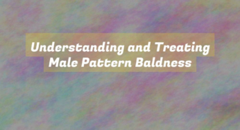 Understanding and Treating Male Pattern Baldness